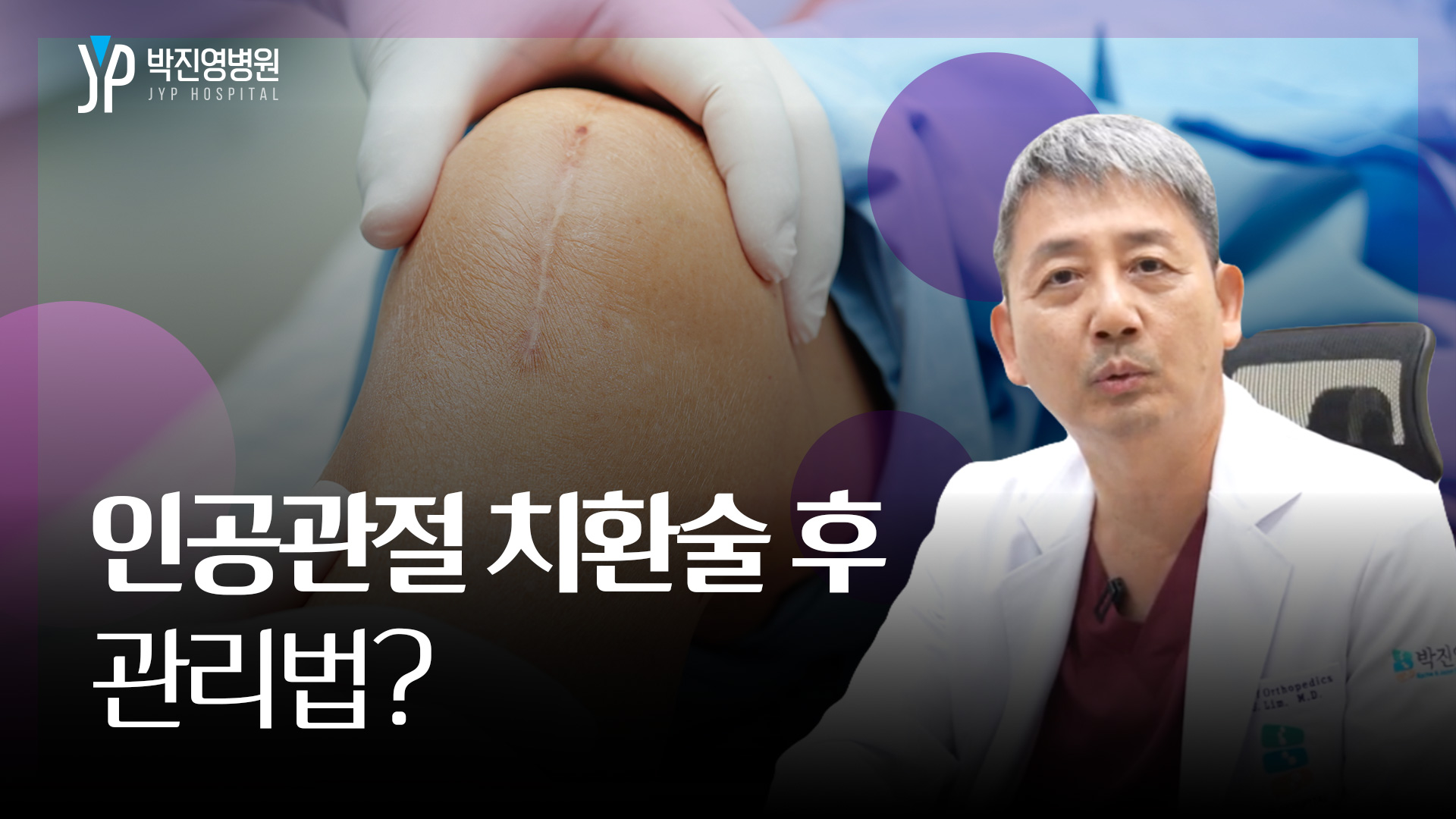 인공관절 치환술 후 관리법