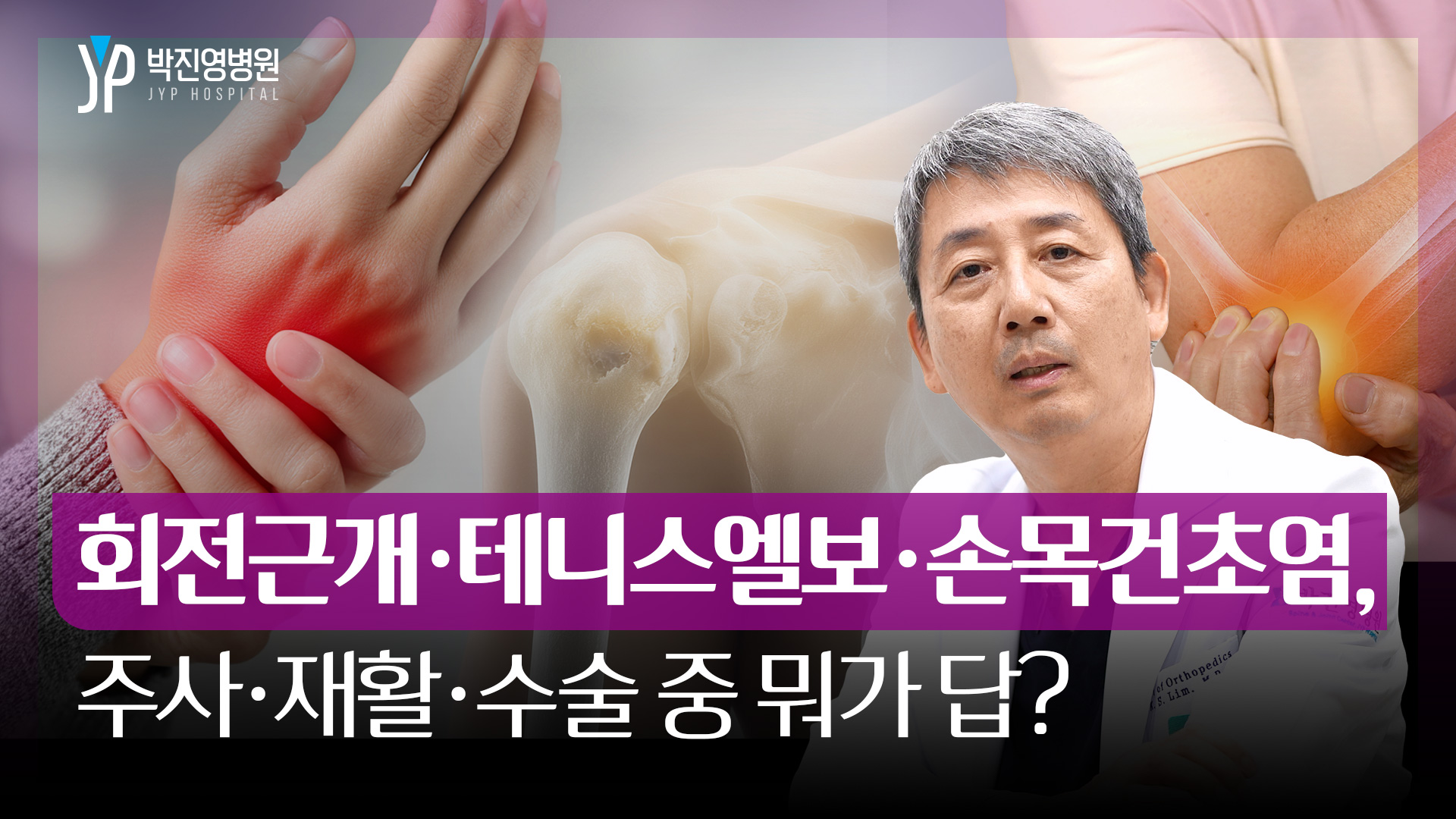 회전근개·테니스엘보·손목건초염, 주사·재활·수술 중 뭐가 답?