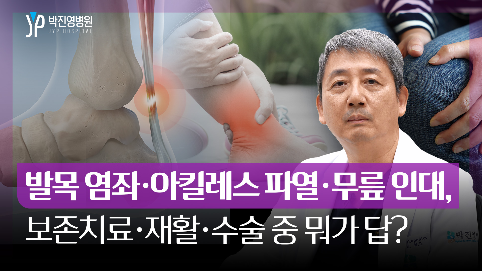 발목 염좌·아킬레스 파열·무릎 인대, 보존치료·재활·수술 중 뭐가 답?
