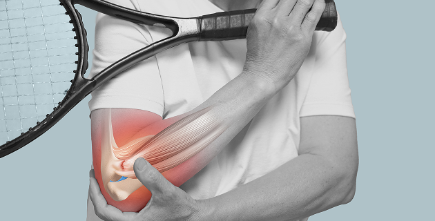 골프/테니스 엘보 원인